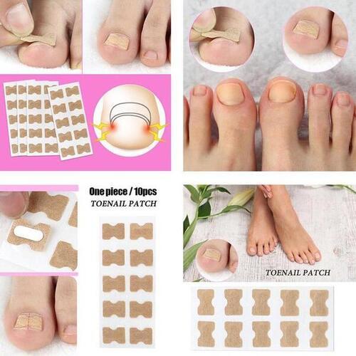 NAILPATCH 1